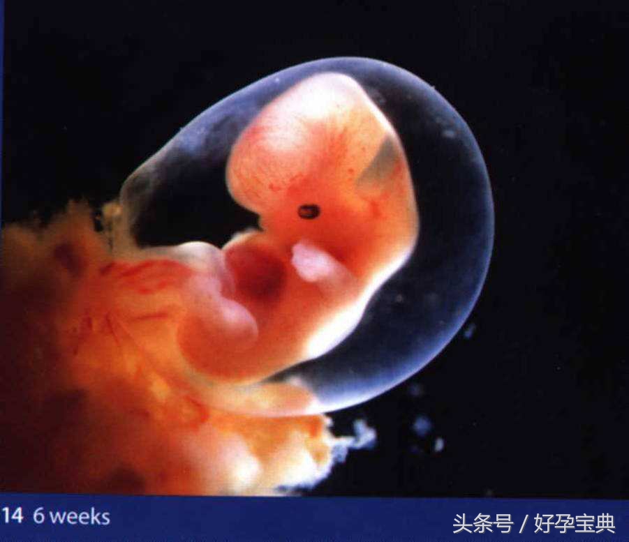 抗磷脂综合征检查多少钱,抗磷脂抗体综合征的表现