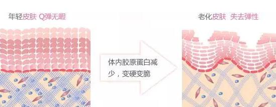 打了瘦脸针脸下垂怎么办,瘦脸针后脸下垂怎么办