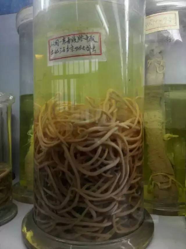 男子身体养虫,河南男子体内长虫