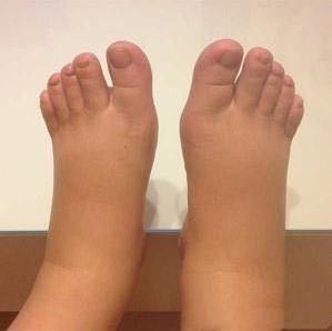 8大症状预示要来月经,快来大姨妈症状