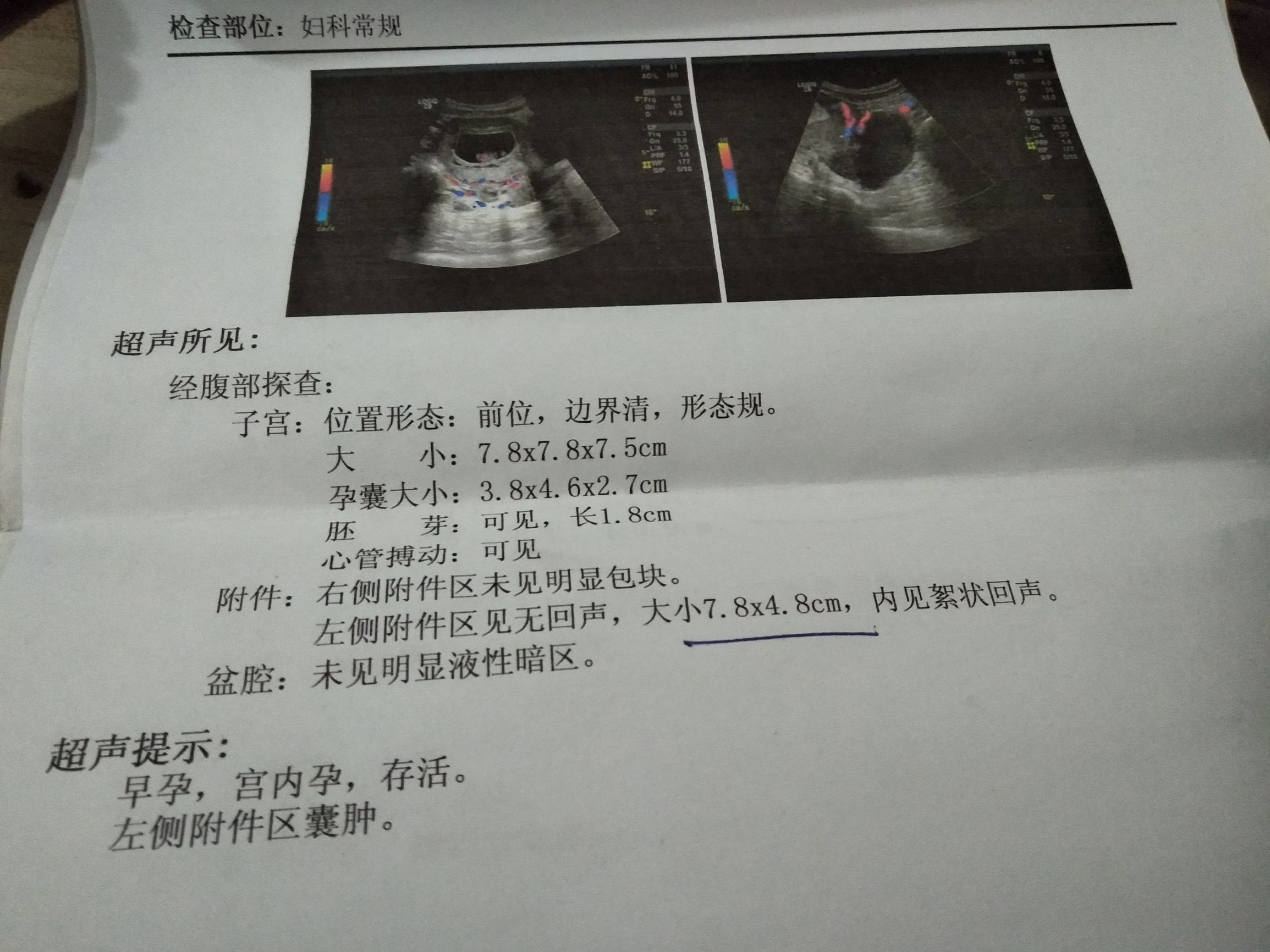 孕30周胎盘低置轻微出血淡红色,孕囊旁有液性暗区考虑积血可能