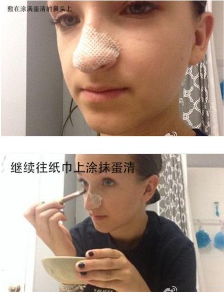 国货去黑头收缩毛孔十大排行,男性收缩毛孔去黑头最佳方法