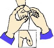 过敏性鼻炎咳嗽推拿哪些穴位,过敏性咳嗽变异性哮喘推拿