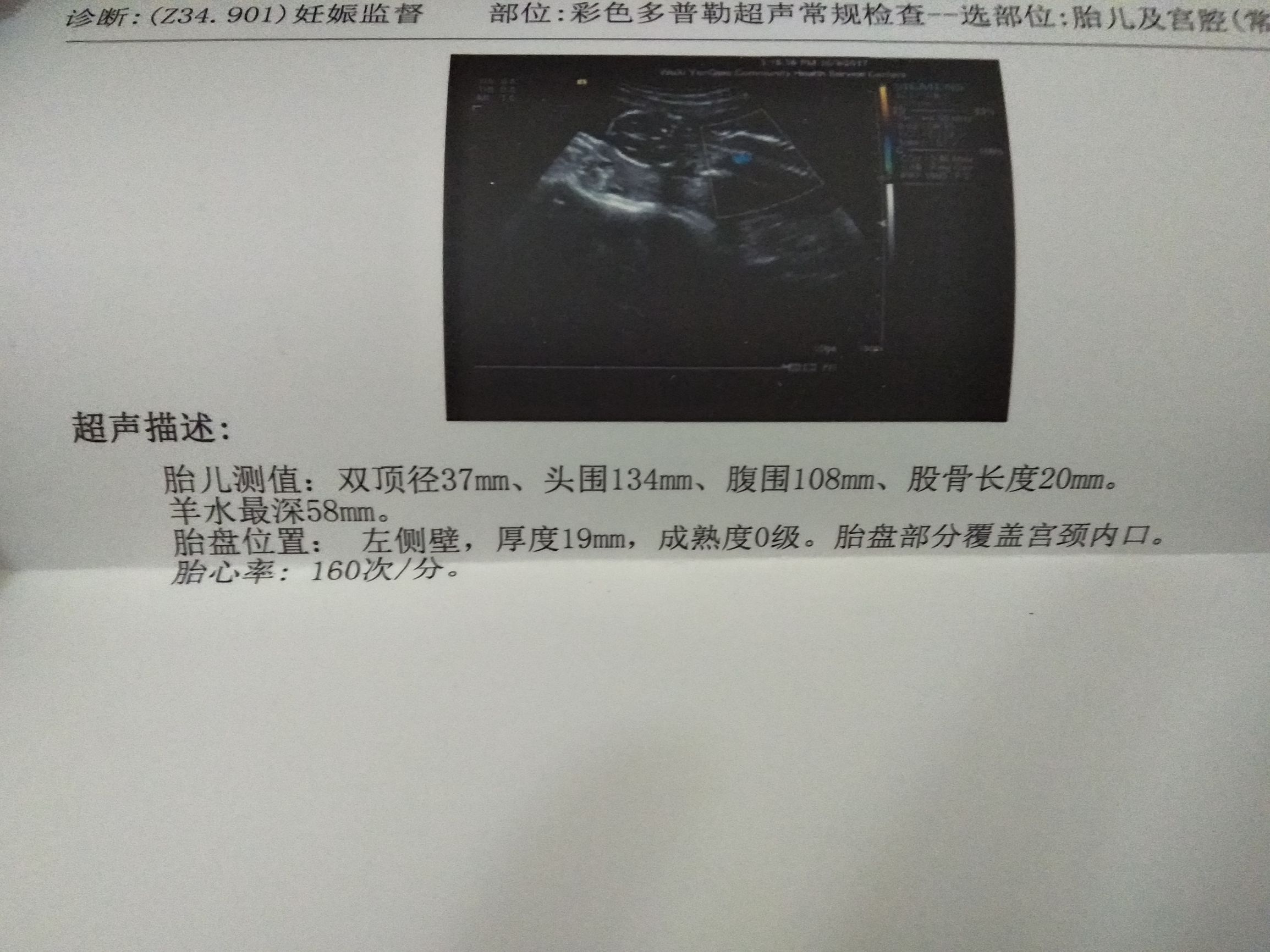 孕30周胎盘低置轻微出血淡红色,孕囊旁有液性暗区考虑积血可能