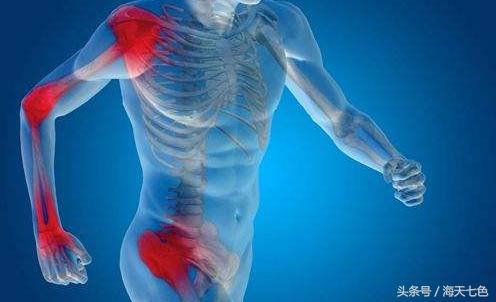 类风湿关节炎艾灸疗法,关节炎艾灸哪些穴位好