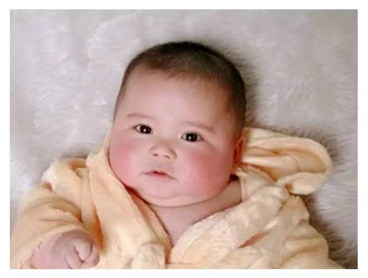 新生儿0-1个月护理脸部,新生儿常见皮肤疾病及护理