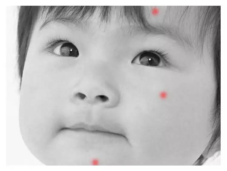 新生儿0-1个月护理脸部,新生儿常见皮肤疾病及护理