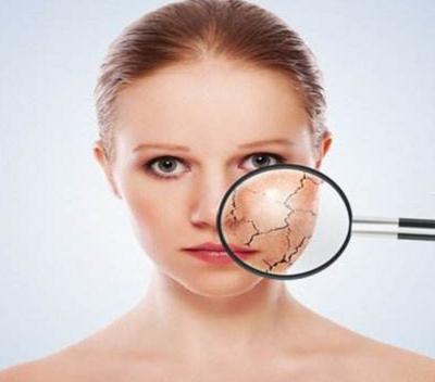 冬季皮肤干燥发痒怎么办吃什么药,冬季皮肤干燥发痒怎么保养