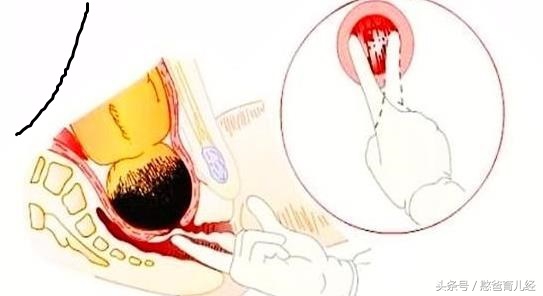 女人开宫口怎么缓解腹痛,女人开十指的痛苦时刻