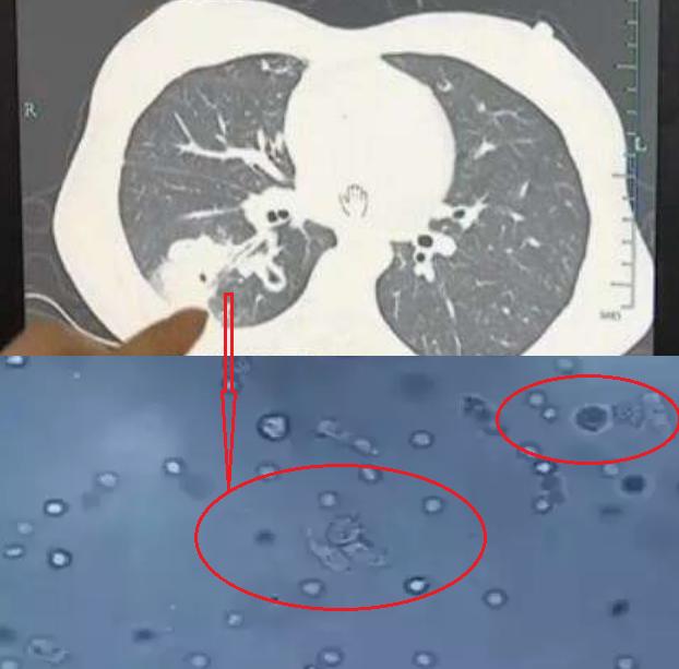 8岁女孩反复高烧第四天,8岁女童半夜发高烧