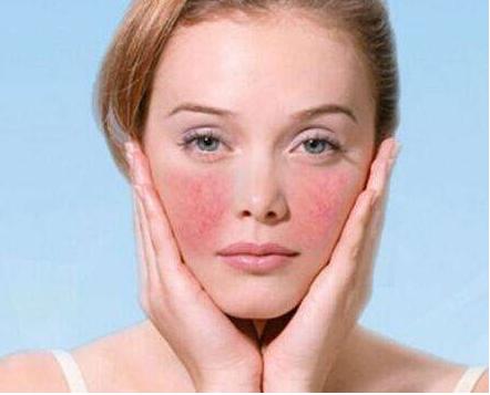 小孩脸部过敏怎么护理,过敏期脸部护理