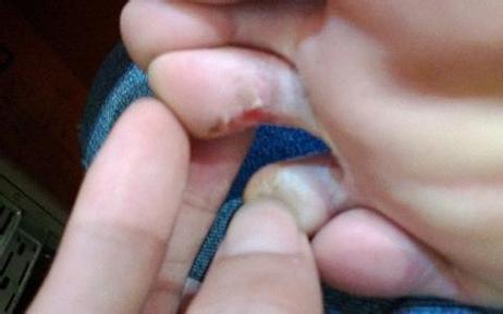 脚底起皮痒还有脚气有什么小偏方,脚气小偏方藿香正气水能治脚气吗