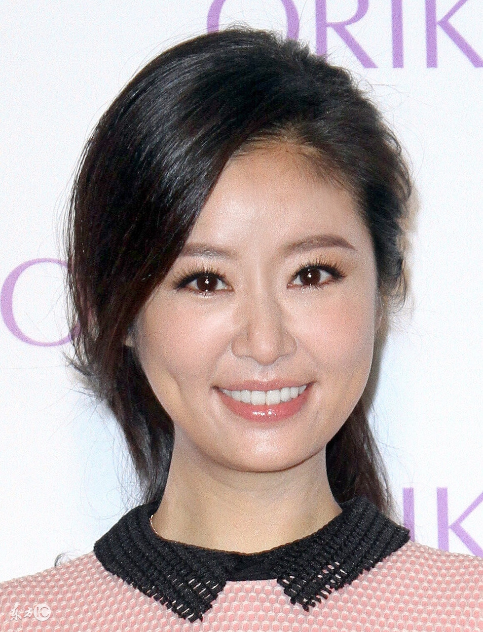 高圆圆戴牙套前后对比,高圆圆牙齿矫正牙套戴了几年