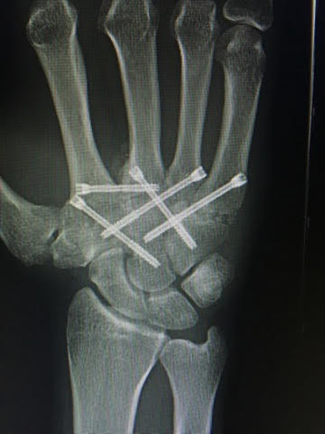 拳击一拳力量,拳击选手一拳的力量