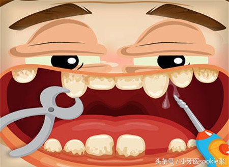 拔牙后有哪些注意事项,拔牙缝线后注意事项