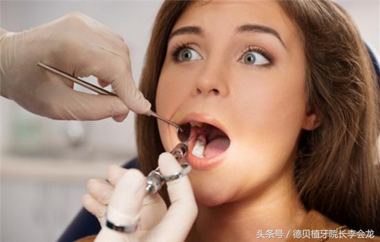 美容冠矫正牙齿有什么危害,美容冠危害图片大全