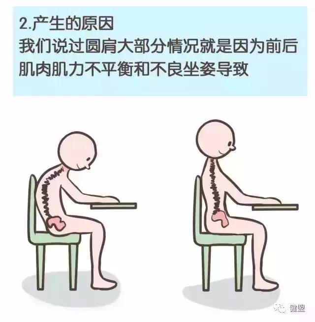 成年人驼背耸肩,一招拯救圆肩驼背