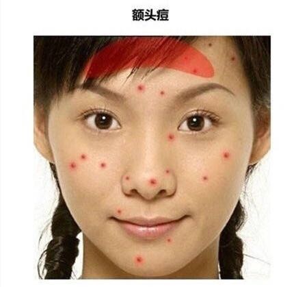 「看图识别长痘原因」还在苦恼长痘，如何祛痘，点开此文绝不后悔
