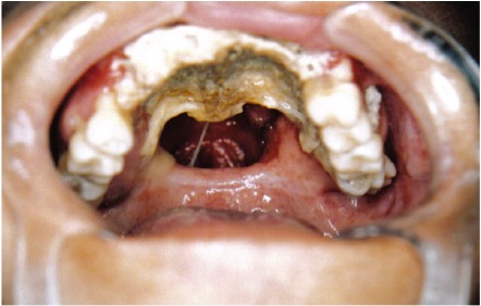 中年男人身体发臭是什么病,中年男人嘴里发臭是怎么回事