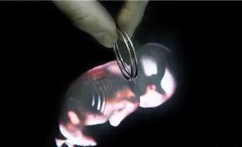 上环对女人有什么危害嘛,人流和上环一起对身体有害吗