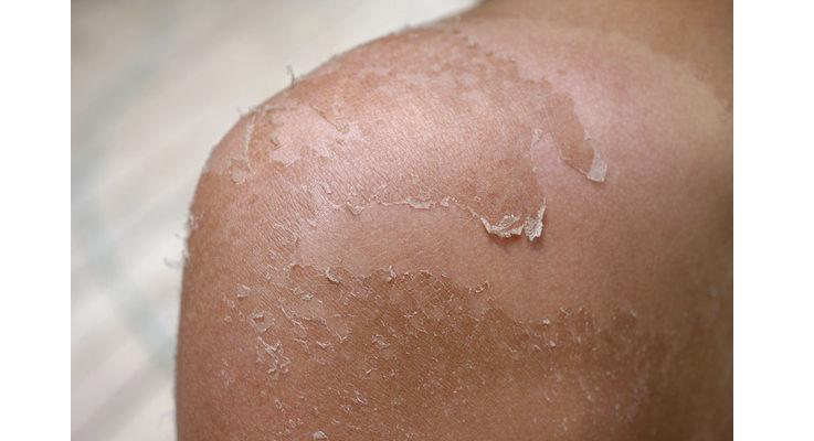 吃对了才有营养,保持皮肤白皙透亮每天必吃维c