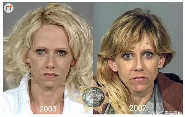 10个吸毒前后的惊人变化,吸毒的人吸毒前后对比图片