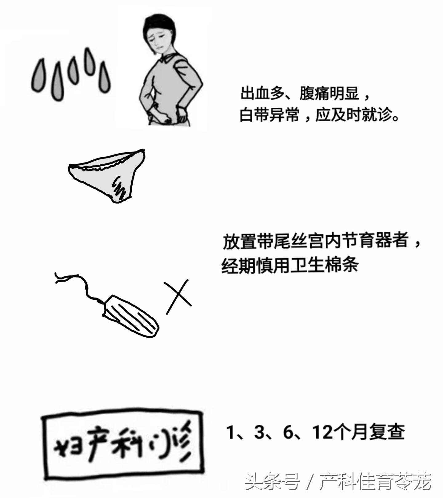 放置宫内节育器请什么假,宫内节育器放置全过程