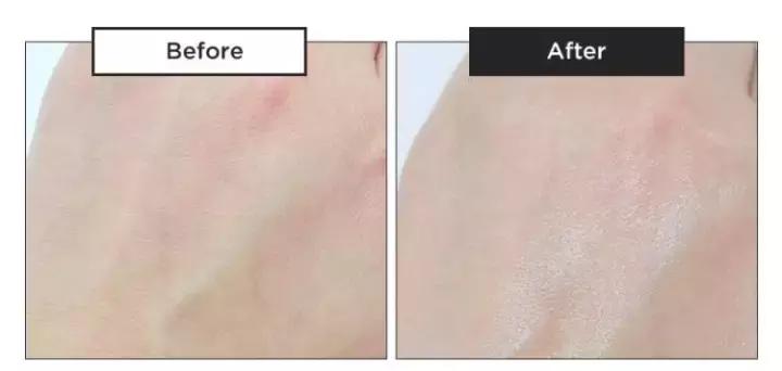 最近肌肤干燥紧绷那先从换这“五款秋冬超保湿的精华水”开始吧……