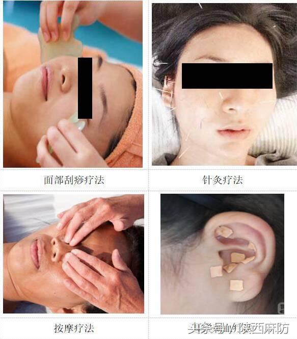 褐青色斑什么季节做比较好,褐斑有哪些