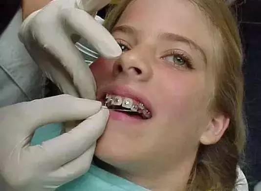 矫正牙齿明明不疼了又开始疼,矫正牙齿垫高咬合难受怎么办