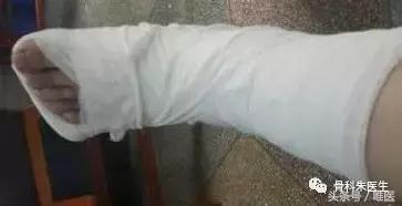 踝关节扭伤后保守穿护踝有用吗,踝关节扭伤韧带撕裂保守治疗