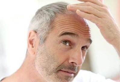 睡眠不足头发脱落严重,长期睡眠不足头发还能长回来吗