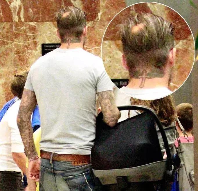 关于脱发你需要知道这10个真相,关于脱发你必须知道的真相