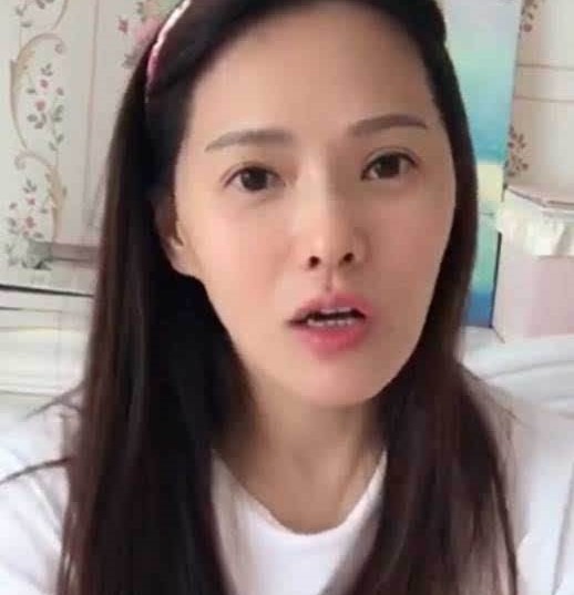 牙凸戴牙套矫正的全过程,箍牙的牙套很难看