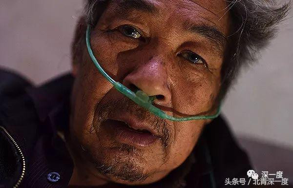 尘肺病用的制氧机,尘肺病患者求闲置呼吸机