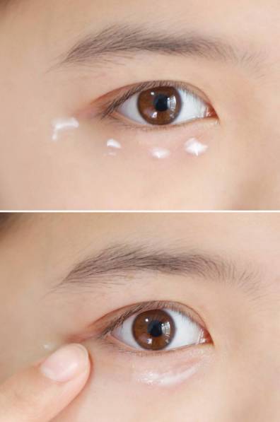 色素型黑眼圈加眼袋怎么解决,戳到眼睛眼白一块血块怎么办