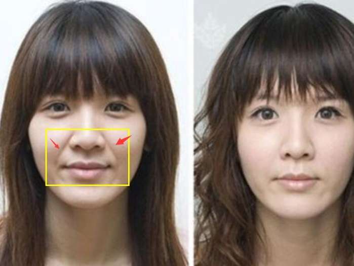 杨紫同款法令纹怎样去除,杨紫的法令纹怎么去掉的