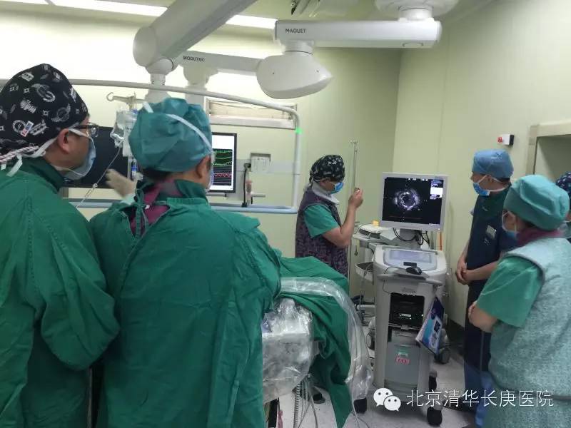 心血管超声技术,心血管超声最新技术