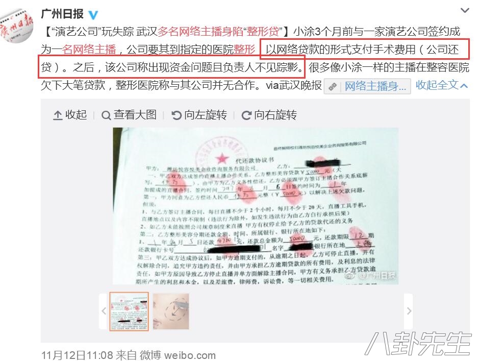 娱乐圈里整容过的演员,娱乐圈整容失败女星