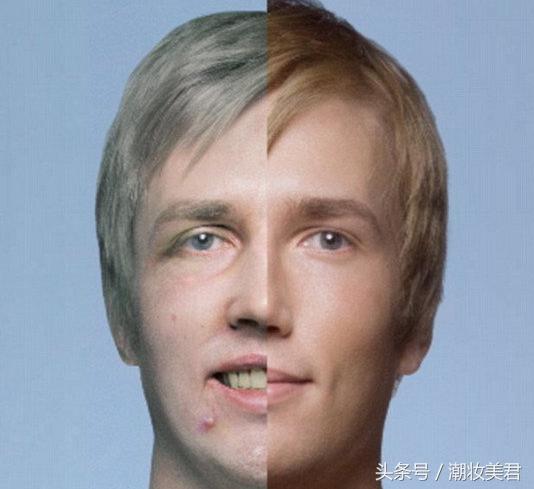 怎么减少吸烟对皮肤的伤害,吸烟对人皮肤的危害怎么恢复