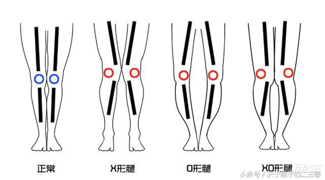 腿型不直适合穿什么款型靴子,155腿粗o型腿穿什么靴子