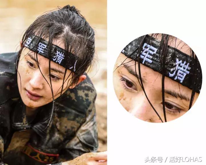 拯救发际线的生发神器,拯救发际线神器