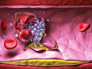 房颤患者是保守治疗还是积极治疗,房颤最主要的治疗是控制心率吗