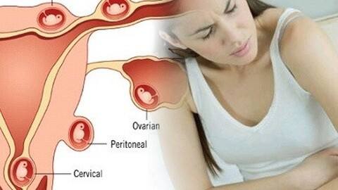 怎么及时发现宫外孕,宫外孕如何及时发现及时处理