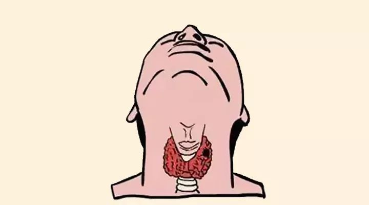 别再中招！体检发现这个“结节”，赶紧这么办