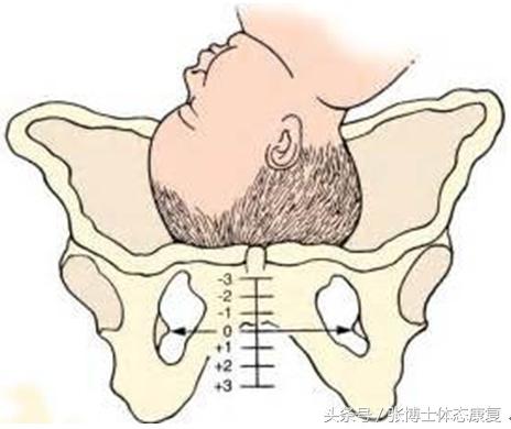 运动耻骨疼痛是什么原因,运动耻骨肌痛如何缓解