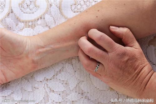 三甲医院通用的《疾病先兆自查表》,我用了几十年,现在还在用!