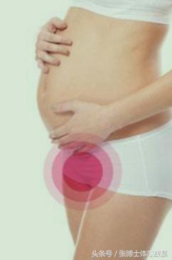 孕期耻骨疼多锻炼可以缓解吗,孕期耻骨疼怎么通过锻炼缓解