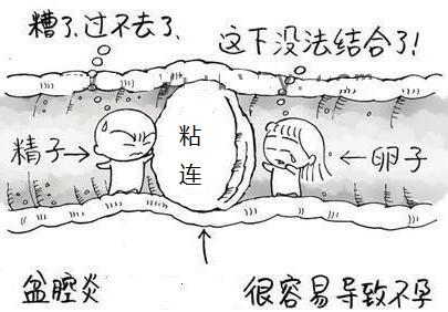 盆腔炎积液的症状怎么治疗,盆腔炎的症状与治疗方剂