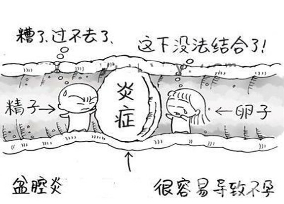 盆腔炎必须手术治疗么,盆腔炎需要手术治疗吗